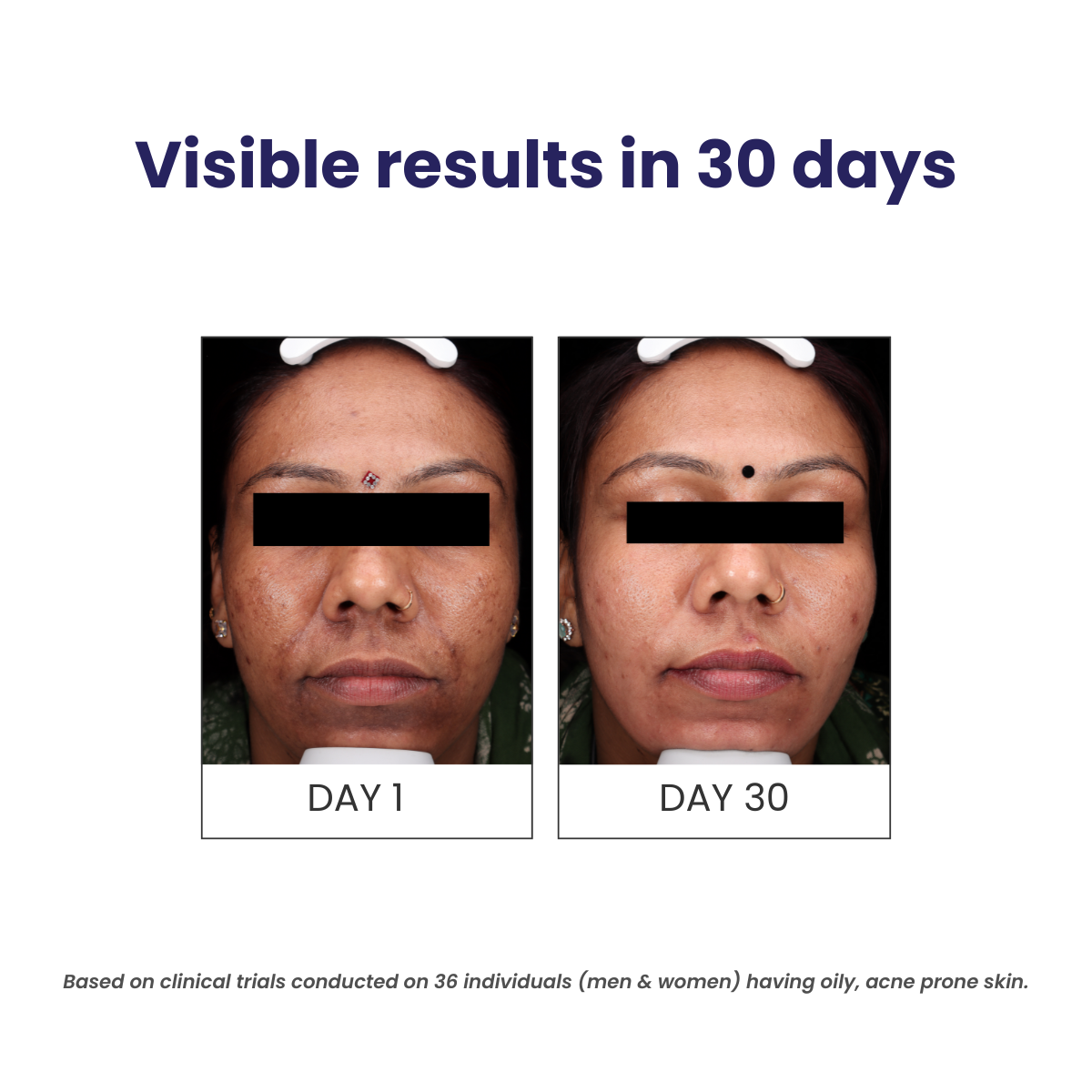 Oil Control Face Wash (Pack Of 2)