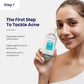 Acne Pimple Treatment Bundle
